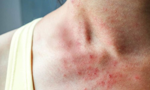 和玻璃罐有什么区别?-竹罐的作用大全图片、竹罐功效大还是玻璃罐大 -竹罐的功效网